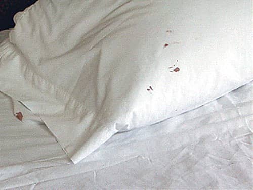 How Do You Know If You Have Bed Bugs? 7 Tell Tale Signs