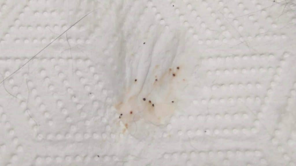 flea dirt on sheets